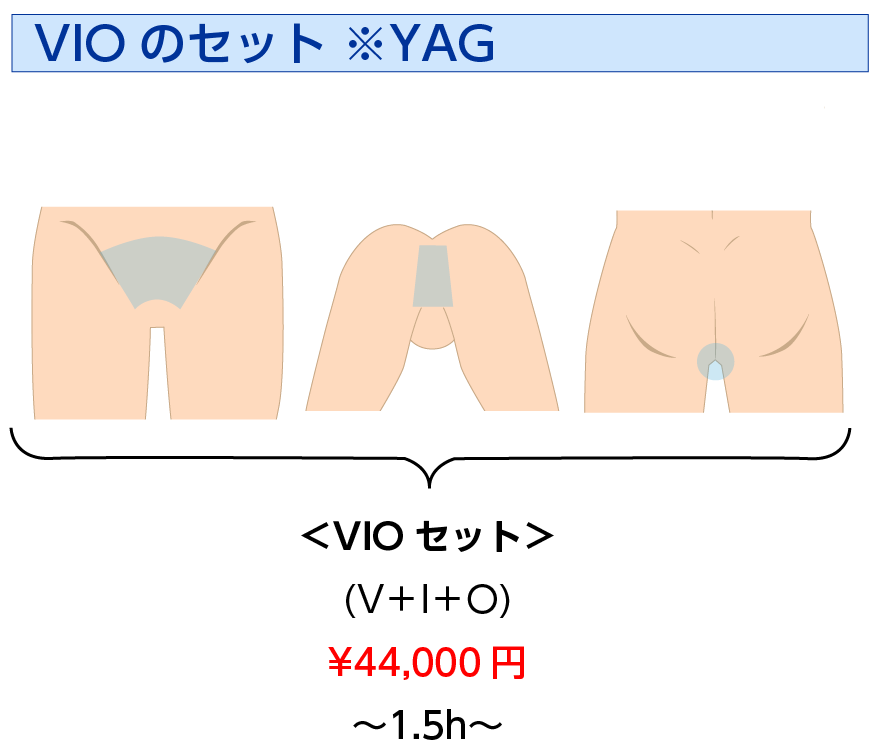 男性レーザー脱毛 VIO