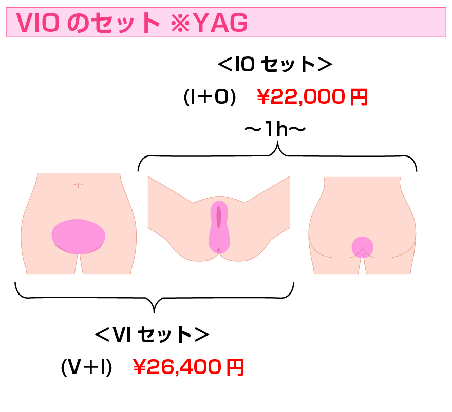 VI+IO | 医療レーザー脱毛