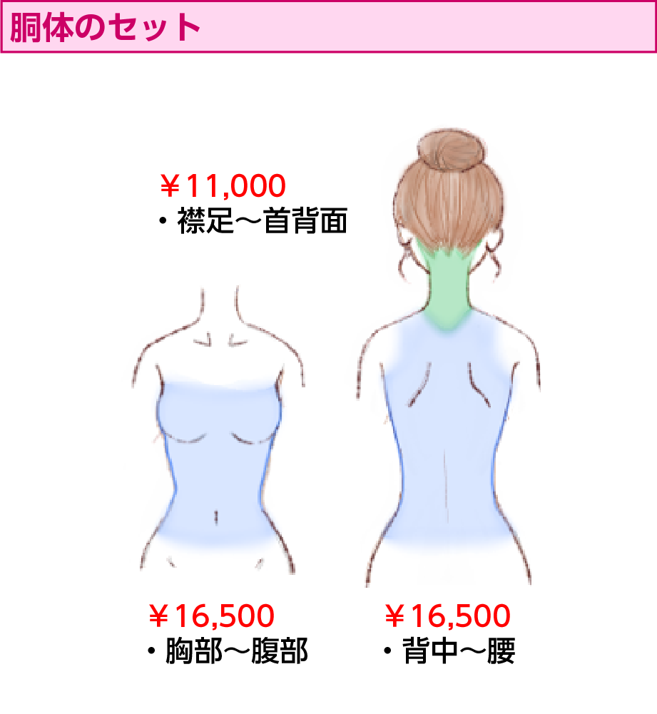 胴体のセット | 医療レーザー脱毛