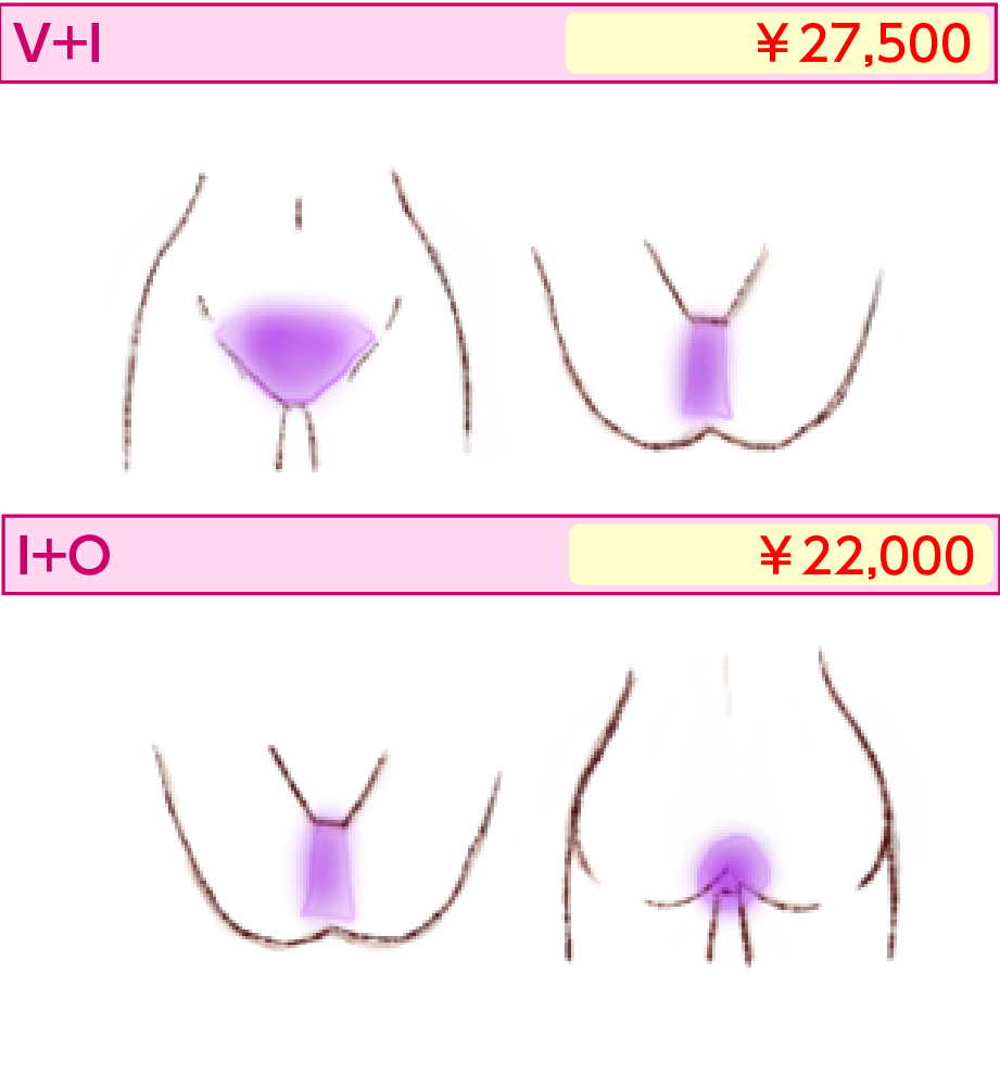 VI+IO | 医療レーザー脱毛