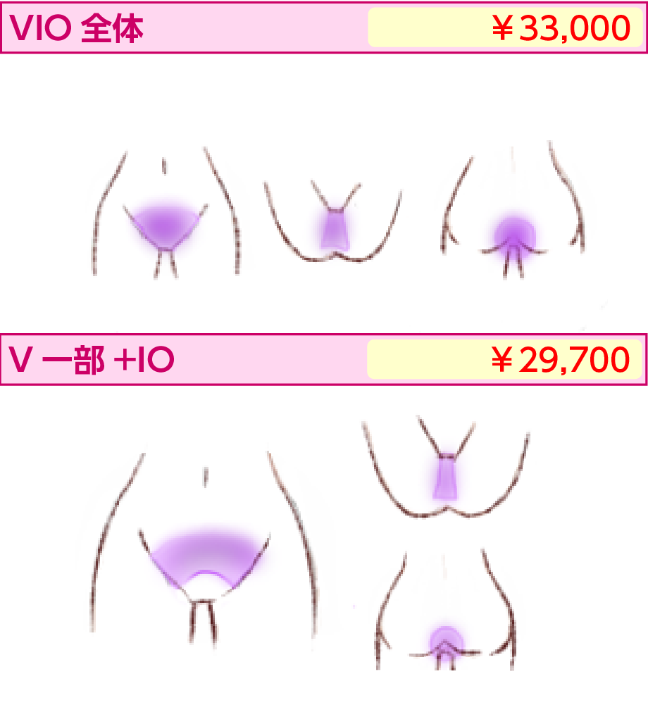 VIO全体と一部 | 医療レーザー脱毛