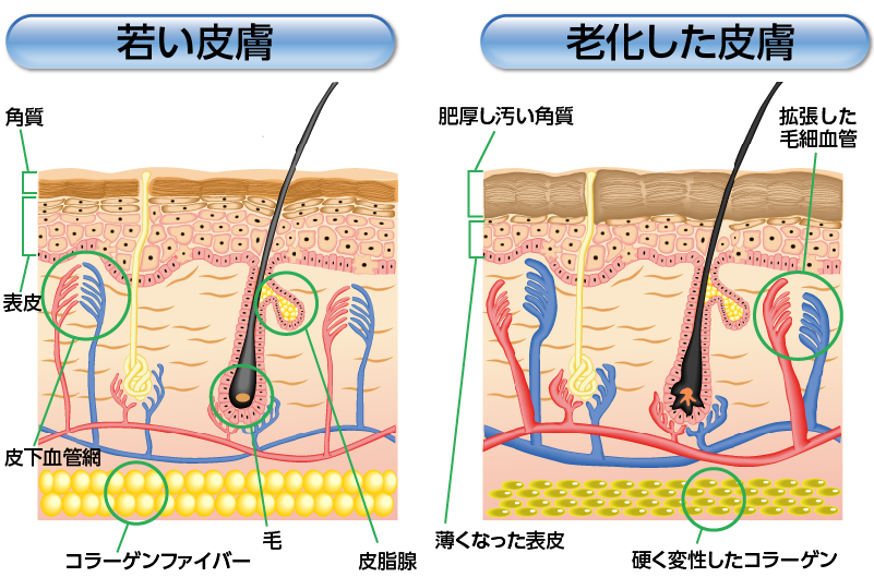 ピーリングとは 酒井形成外科 美容皮膚科