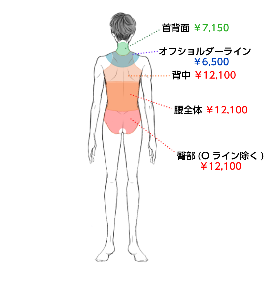 男性レーザー脱毛 価格表 背面