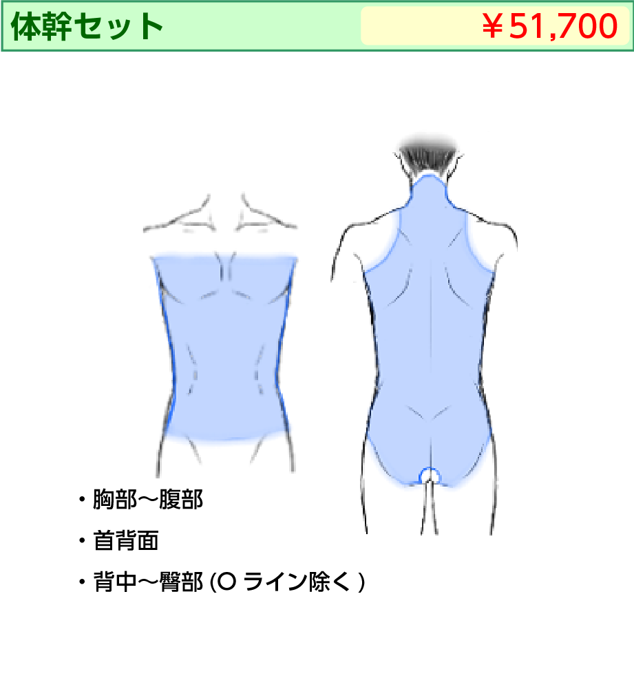 男性レーザー脱毛 体幹セット
