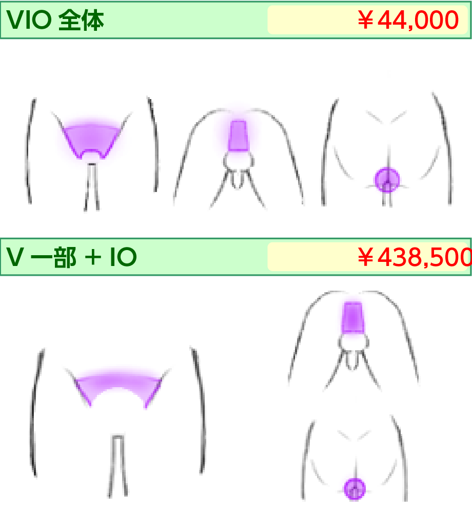 男性レーザー脱毛 VIO