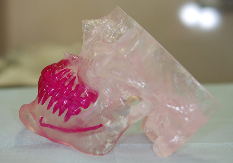 顔面骨3Dモデル