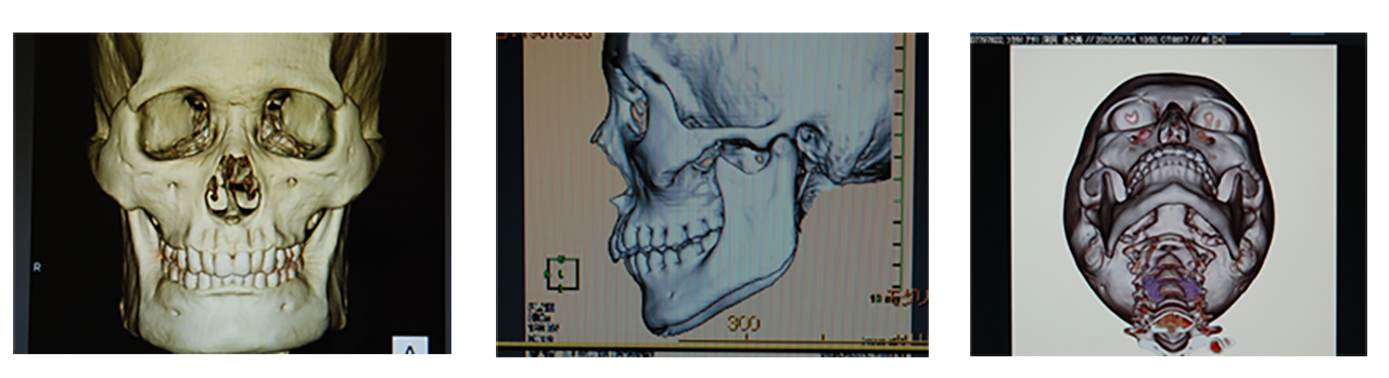 3DCT画像