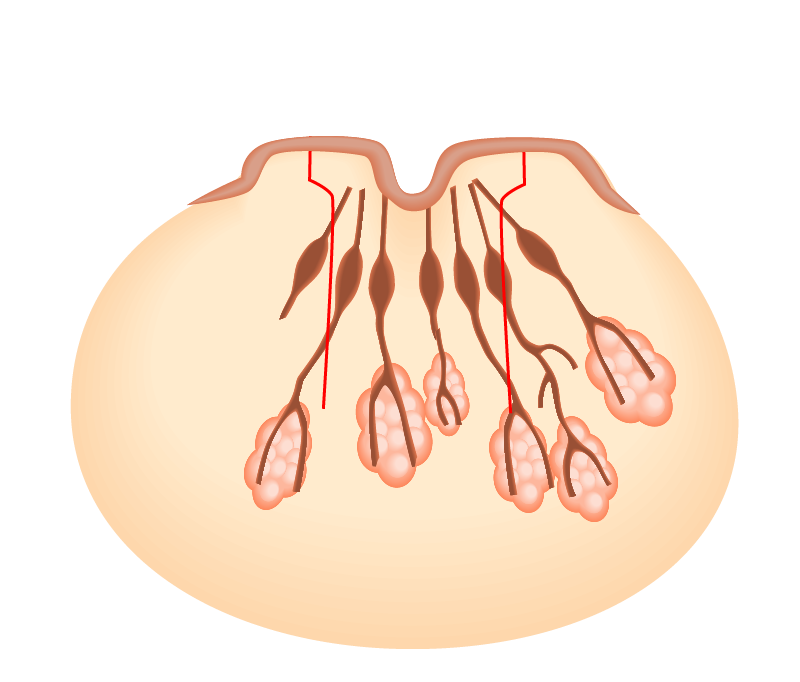 乳管を温存した陥没乳頭のデザイン(断面図)