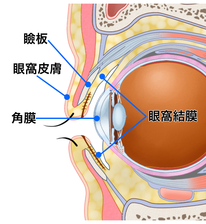結膜・瞼板(タルザス)