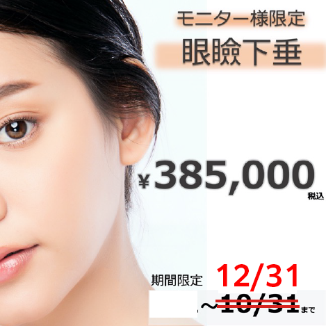 眼瞼下垂のモニター様限定 ¥385,000(税込)